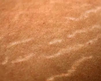 Visualisation de vergetures